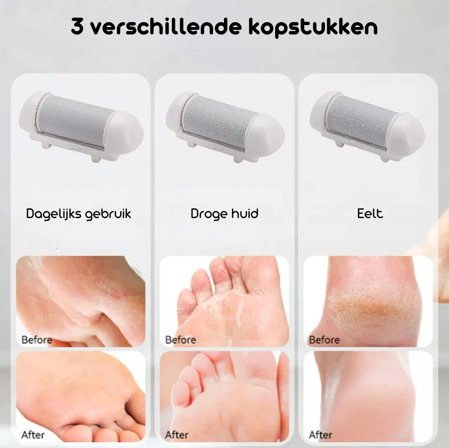 FootCare™ | Snel en effectief!